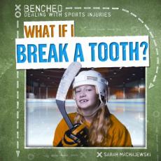 What If I Break a Tooth?