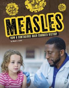 Measles