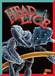 Head Lice