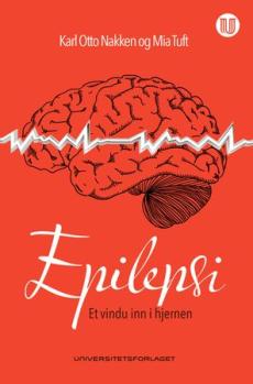 Epilepsi : et vindu inn i hjernen