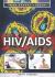 Hiv/AIDS