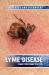 Lyme Disease