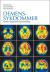 Demenssykdommer : årsaker, diagnostikk og behandling