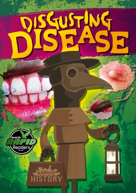 Disgusting disease