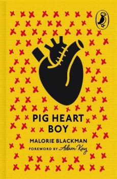 Pig-heart boy