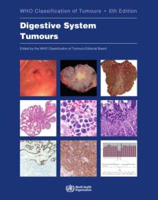 Digestive System Tumours : 1